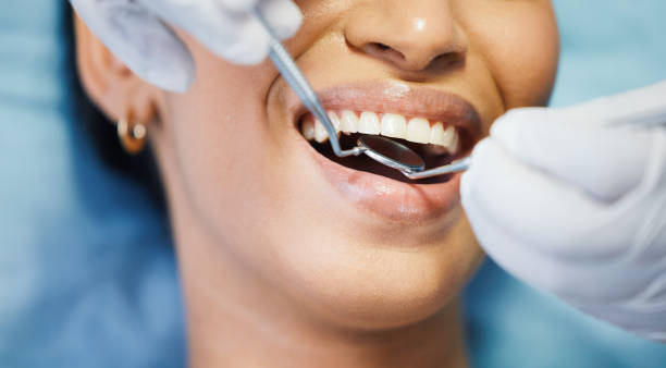 Best Emergency Dental Extractions in Pittsburg, CA